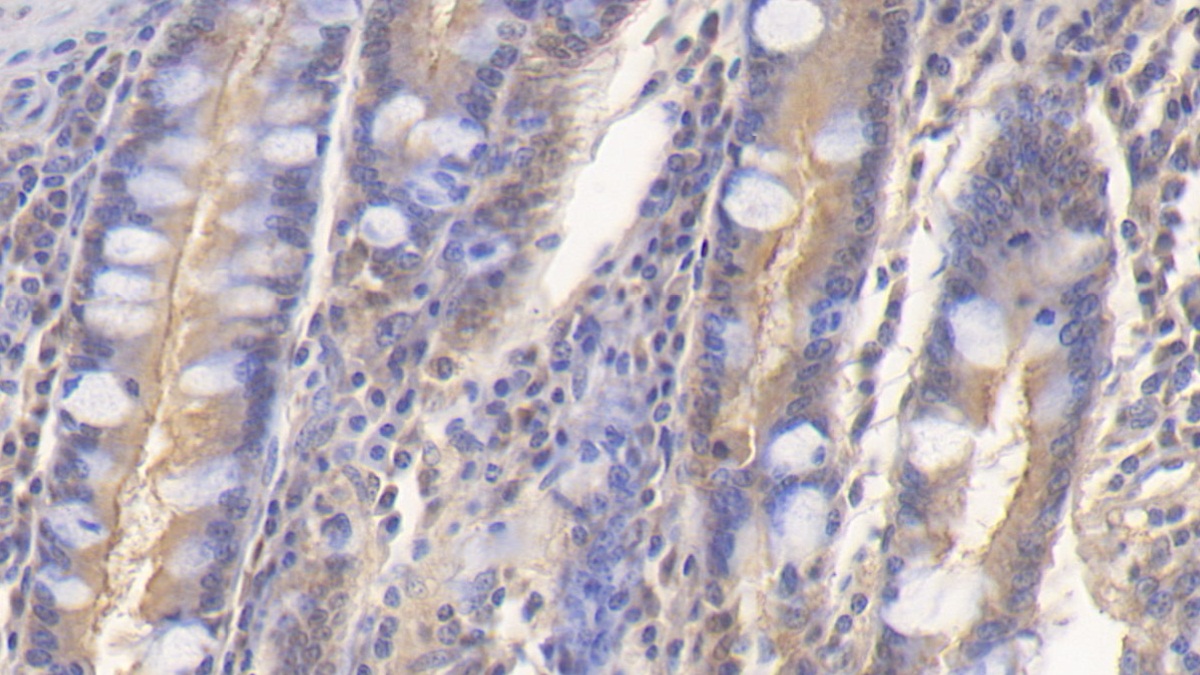 Polyclonal Antibody to Cluster Of Differentiation 164 (CD164)