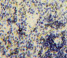 Polyclonal Antibody to B-Cell Linker Protein (BLNK)