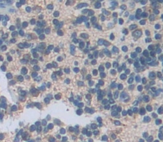 Polyclonal Antibody to B-Lymphocyte Chemoattractant (BLC)