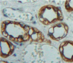 Polyclonal Antibody to Interleukin 10 Receptor Alpha (IL10Ra)