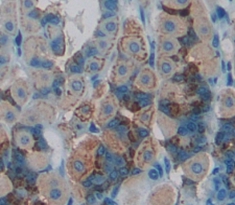 Polyclonal Antibody to Interleukin 10 Receptor Beta (IL10Rb)