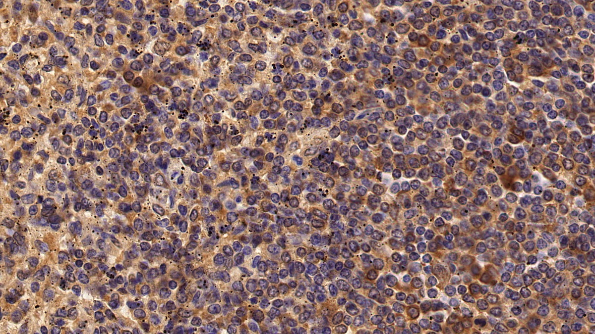 Polyclonal Antibody to Interleukin 18 Receptor 1 (IL18R1)