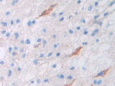 Polyclonal Antibody to Permeability Glycoprotein (Pgp)