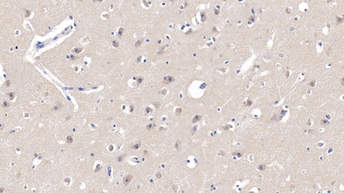 Polyclonal Antibody to Signal Transducer And Activator Of Transcription 1 (STAT1)