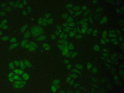 Polyclonal Antibody to Phosphofructokinase, Platelet (PFKP)