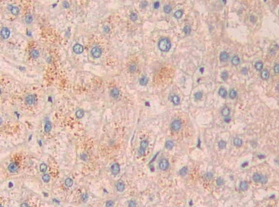 Polyclonal Antibody to Neprilysin (CD10)