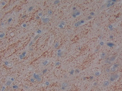 Polyclonal Antibody to Vitamin D Binding Protein (DBP)