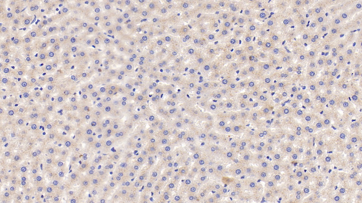 Polyclonal Antibody to Vitamin D Binding Protein (DBP)