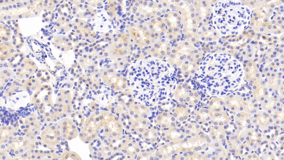 Polyclonal Antibody to Vitamin D Binding Protein (DBP)