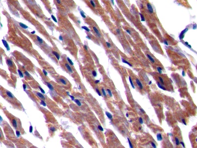 Polyclonal Antibody to Beta Secretase 2 (BACE2)