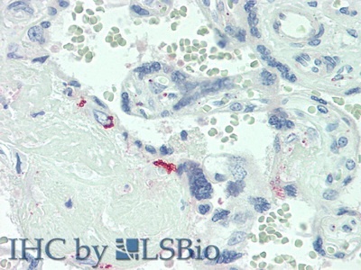 Polyclonal Antibody to Interleukin 6 Receptor (IL6R)