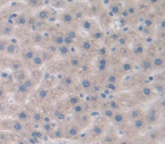 Polyclonal Antibody to Interleukin 6 Receptor (IL6R)