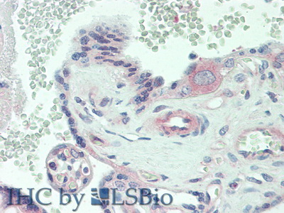 Polyclonal Antibody to Interleukin 6 Receptor (IL6R)