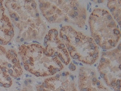 Polyclonal Antibody to Inhibitory Subunit Of NF Kappa B Beta (IkBb)