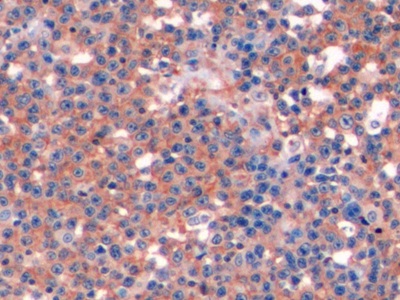 Polyclonal Antibody to Cluster Of Differentiation 19 (CD19)