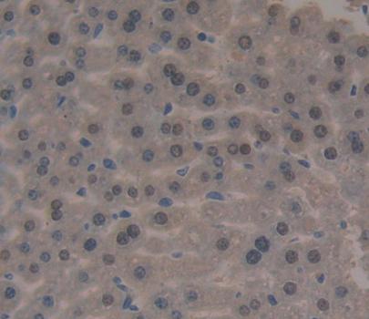 Polyclonal Antibody to Forkhead Box P3 (FOXP3)