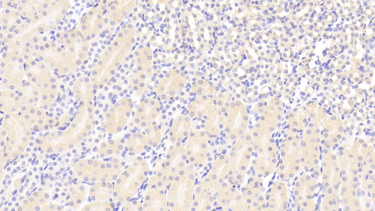 Polyclonal Antibody to Angiotensin I Converting Enzyme 2 (ACE2)