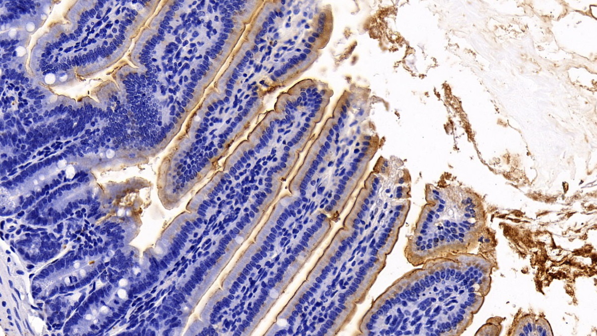 Polyclonal Antibody to Angiotensin I Converting Enzyme 2 (ACE2)