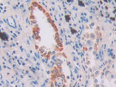 Polyclonal Antibody to Interferon Gamma Inducible Protein 16 (IFI16)