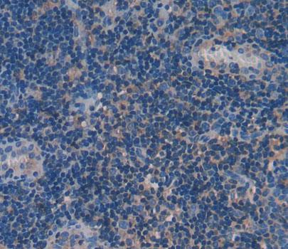 Polyclonal Antibody to Kallikrein 7 (KLK7)