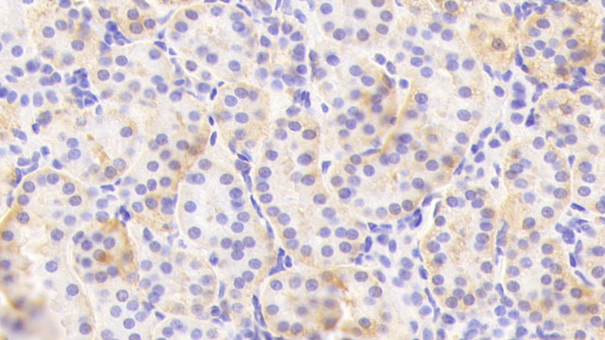 Polyclonal Antibody to Cholinergic Receptor, Nicotinic, Alpha 4 (CHRNa4)