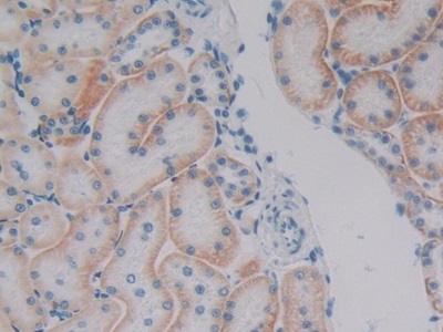 Polyclonal Antibody to Plakophilin 1 (PKP1)