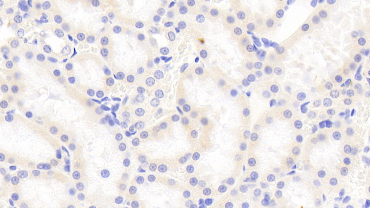 Polyclonal Antibody to Leucine Rich Alpha-2-Glycoprotein 1 (LRG1)
