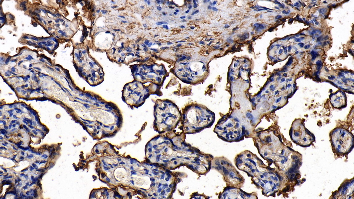 Polyclonal Antibody to Annexin A2 (ANXA2)