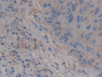 Polyclonal Antibody to Syndecan 1 (SDC1)