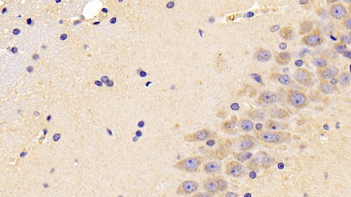 Polyclonal Antibody to Pigment Epithelium Derived Factor (PEDF)