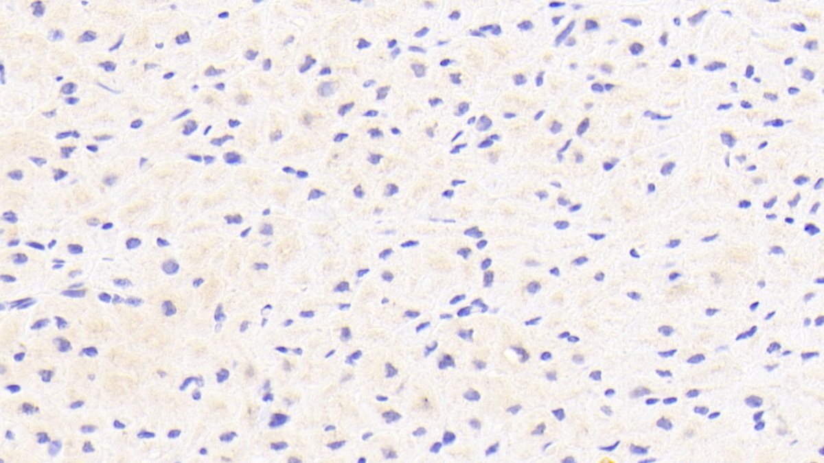 Polyclonal Antibody to Complement Factor I (CFI)