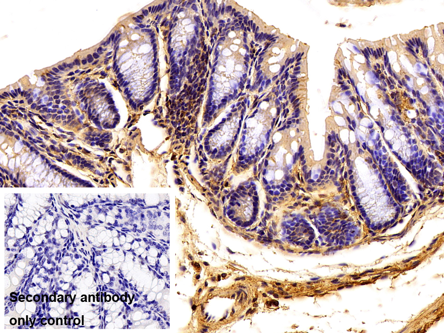 Polyclonal Antibody to Complement Factor I (CFI)