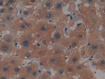 Polyclonal Antibody to Tau Protein (MAPT)