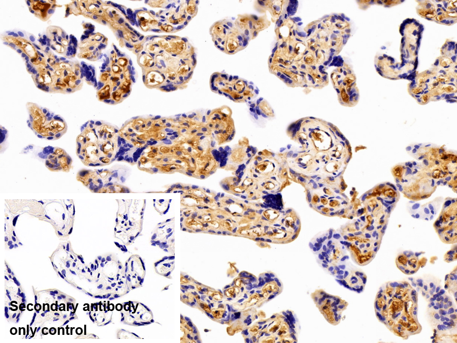 Polyclonal Antibody to Hemopexin (HPX)