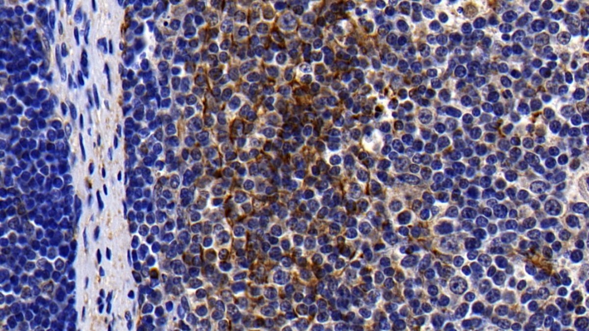 Polyclonal Antibody to Toll Like Receptor 1 (TLR1)