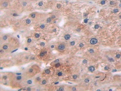 Polyclonal Antibody to Arrestin Beta 1 (ARRb1)