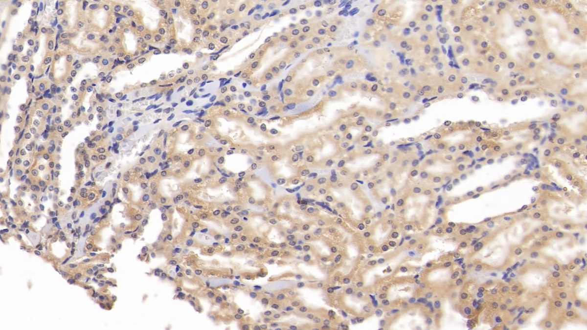 Polyclonal Antibody to Complement Factor B (CFB)