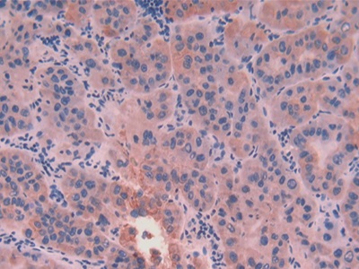 Polyclonal Antibody to Cytokeratin 8 (CK8)