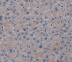 Polyclonal Antibody to Transferrin (TF)