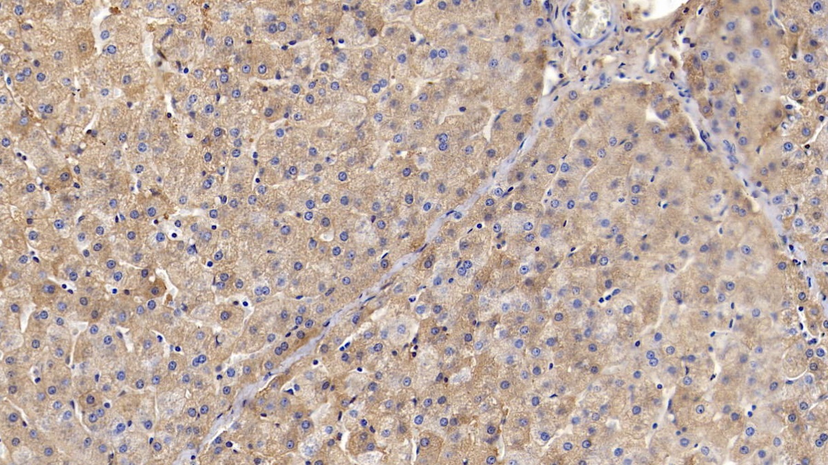 Polyclonal Antibody to Transferrin (TF)