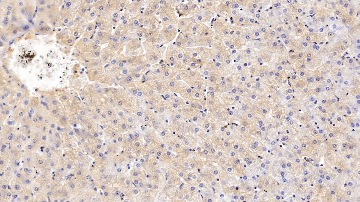 Polyclonal Antibody to Transferrin (TF)