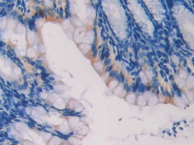 Polyclonal Antibody to Laminin Beta 2 (LAMb2)