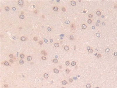 Polyclonal Antibody to Laminin Beta 2 (LAMb2)