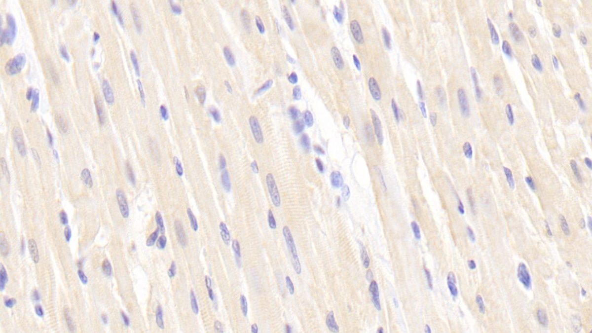 Polyclonal Antibody to Laminin Beta 2 (LAMb2)