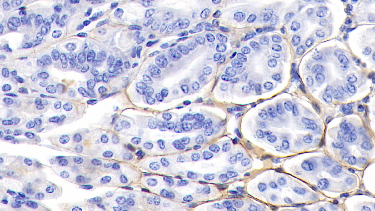 Polyclonal Antibody to Laminin Gamma 1 (LAMC1)