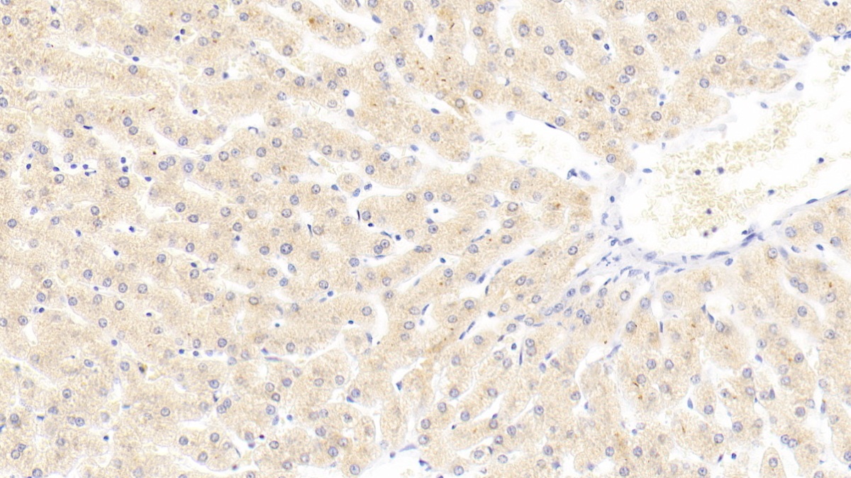 Polyclonal Antibody to Laminin Gamma 3 (LAMC3)