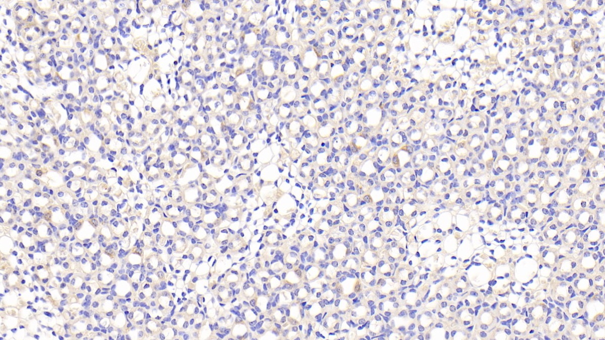 Polyclonal Antibody to Growth Differentiation Factor 6 (GDF6)