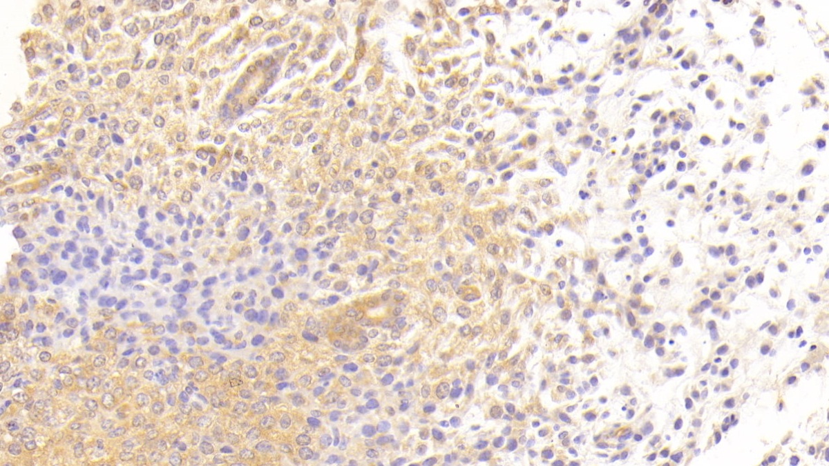 Polyclonal Antibody to Transforming Growth Factor Beta Receptor III (TGFbR3)