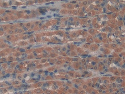 Polyclonal Antibody to Gremlin 1 (GREM1)