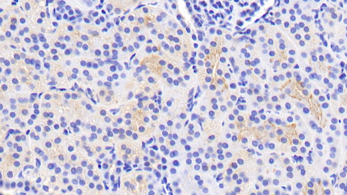 Polyclonal Antibody to Glial Cell Line Derived Neurotrophic Factor Receptor Alpha 2 (GFRa2)